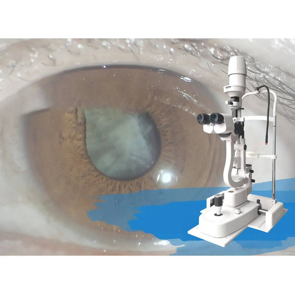 High Quality Ophthalmic Camera Portable Digital Slit Lamp